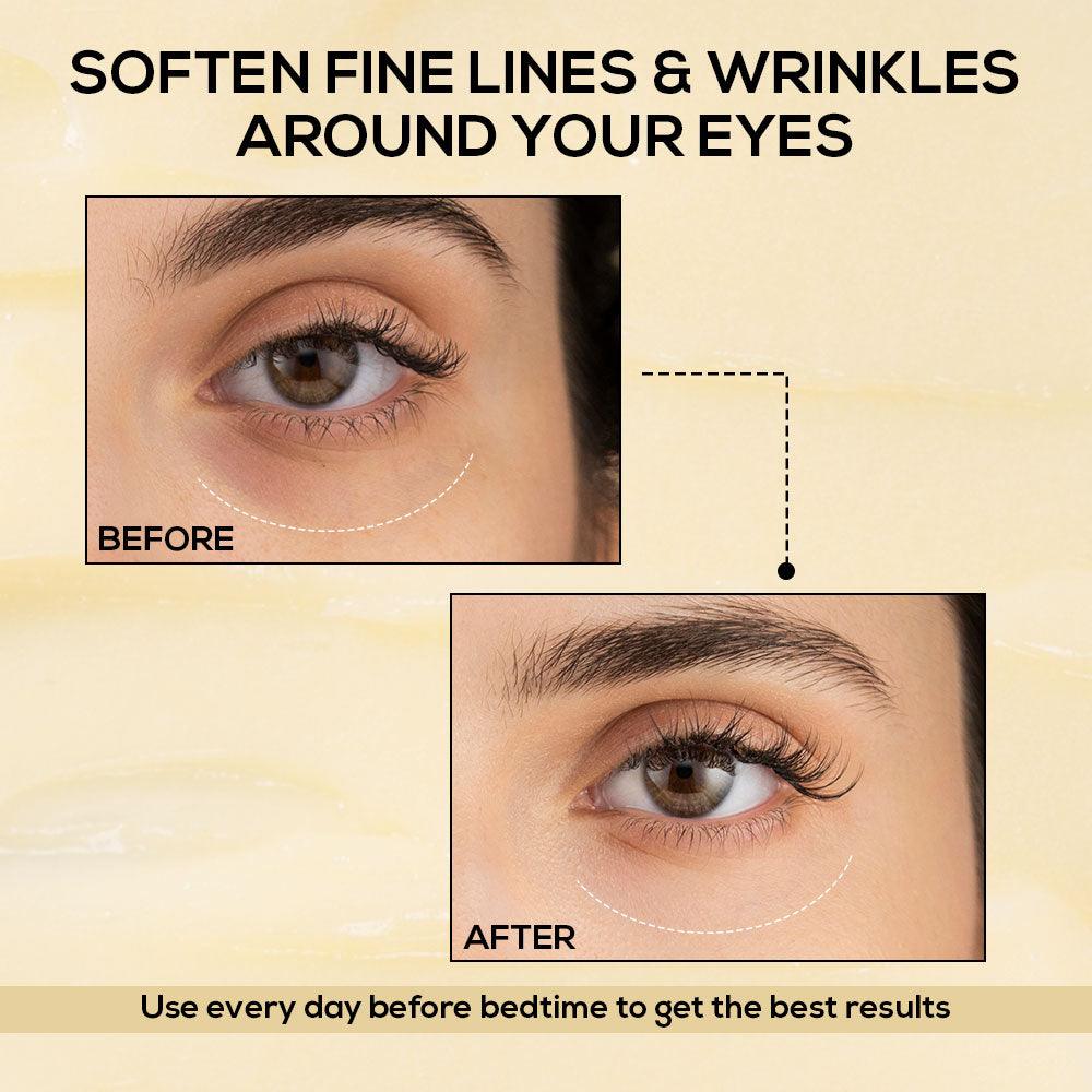 RENEE Retinol Eye Stick — Brighten • Smooth • Refresh — image 6